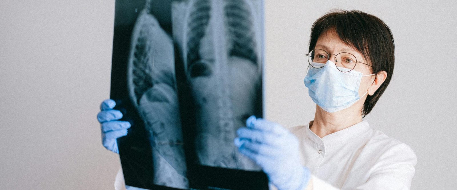 ¿Cuánto paga la ART por una fractura de fémur?